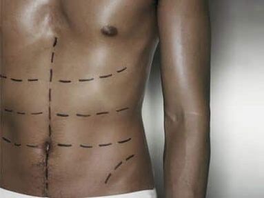 Corpo masculino